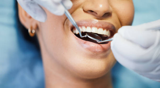 Best Emergency Treatment for Oral Infections in East Quincy, CA